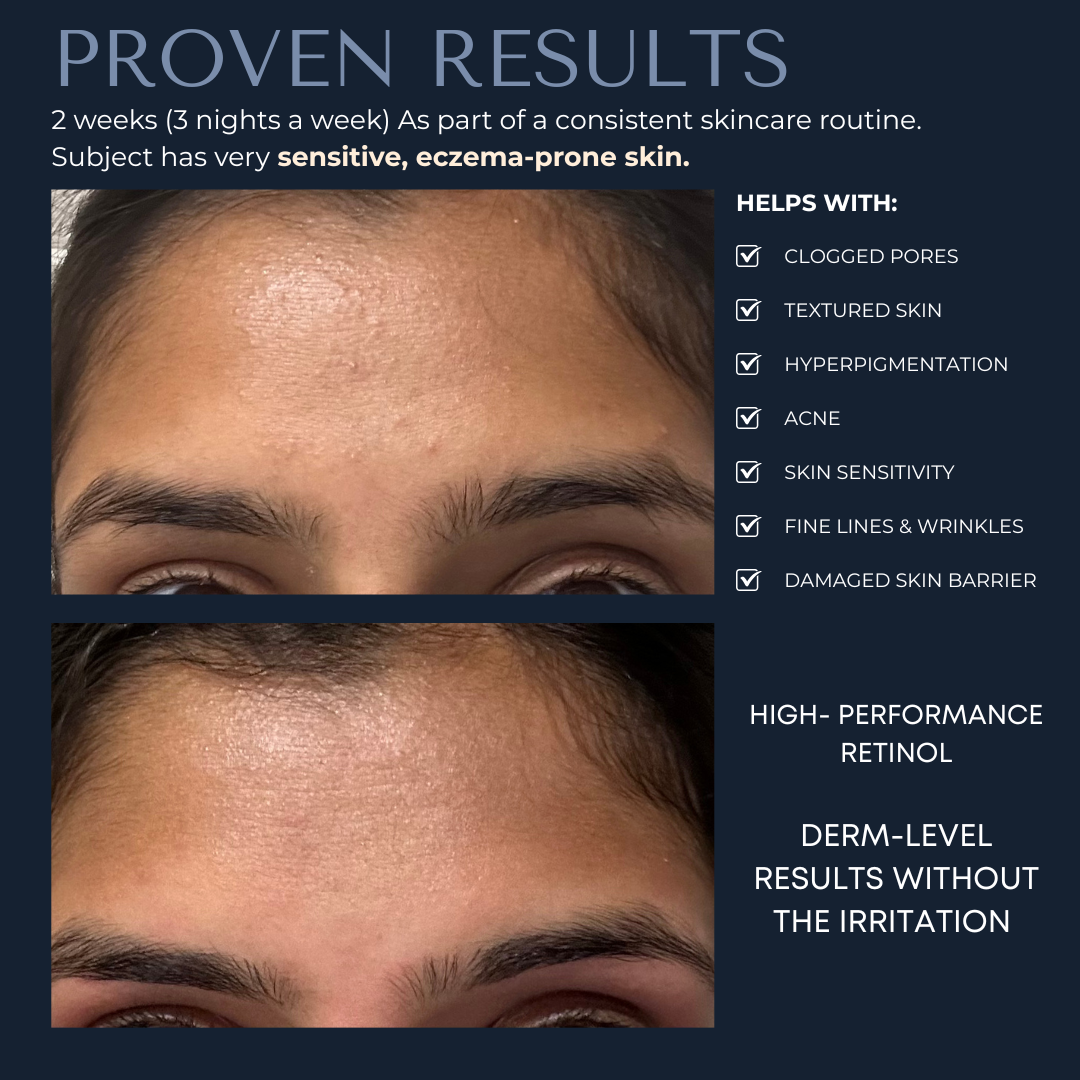 1% Retinol Night Treatment