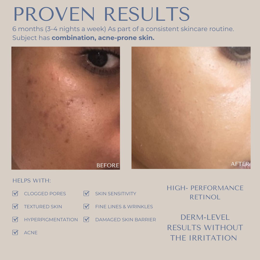 The Essentials Bundle